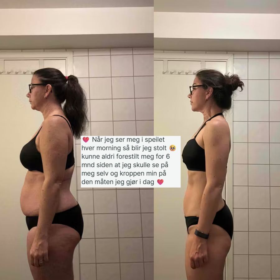Therese før og etter, sett fra siden